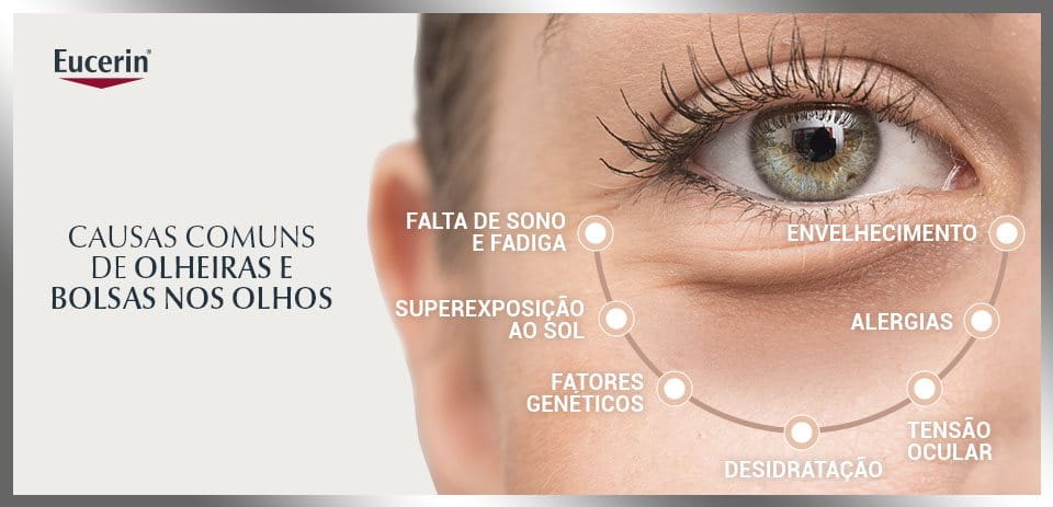 O que causa olheiras e bolsas nos olhos? | Eucerin®